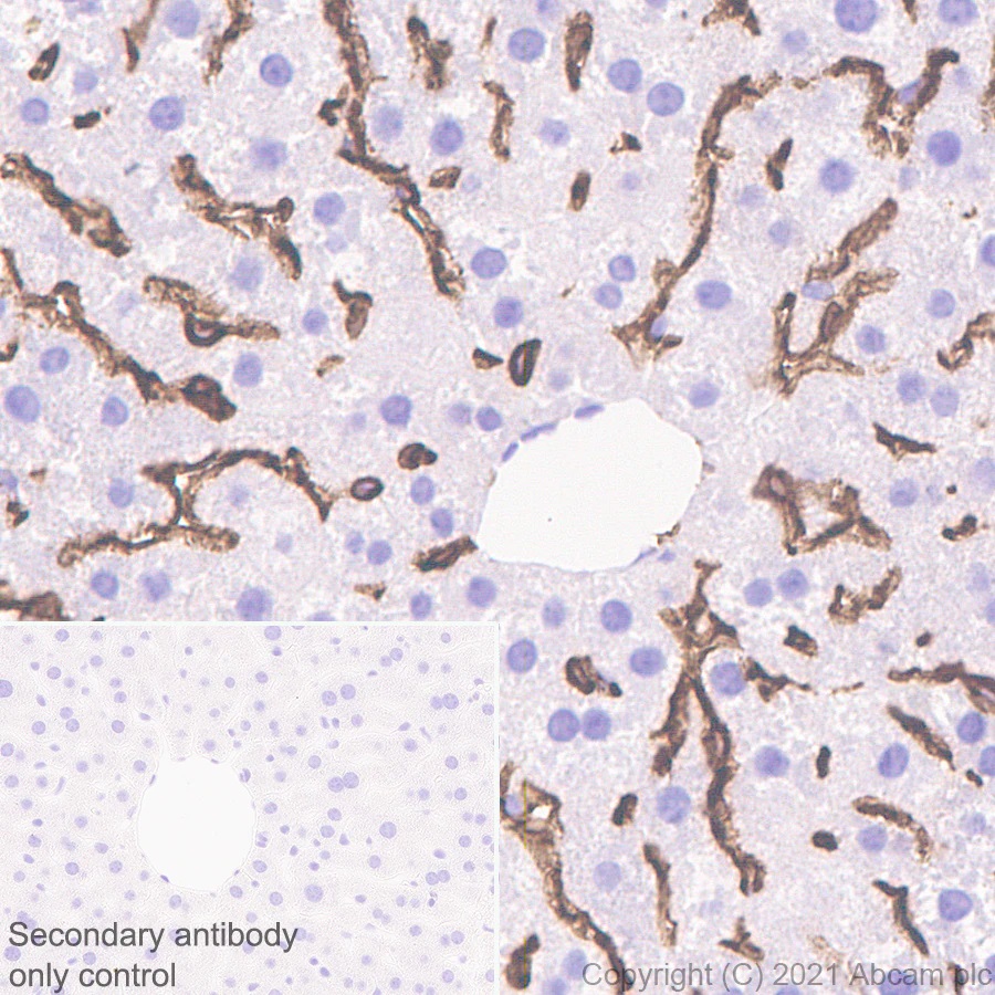 Immunohistochemistry (Formalin/PFA-fixed paraffin-embedded sections) - Anti-LYVE1 antibody [RM1008] - BSA and Azide free (AB282748), expandable thumbnail