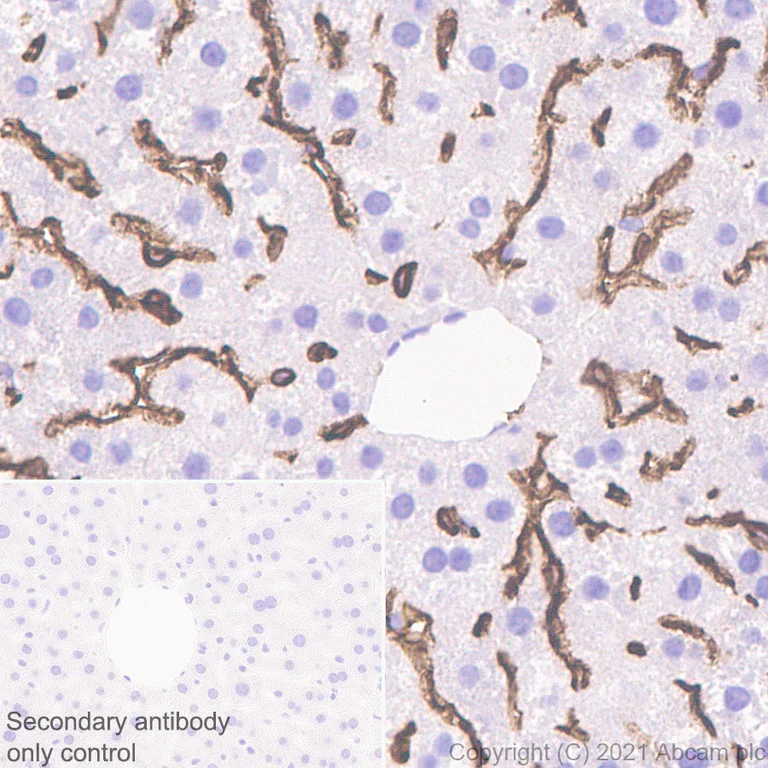 Immunohistochemistry (Formalin/PFA-fixed paraffin-embedded sections) - Anti-LYVE1 antibody [RM1008] - BSA and Azide free (AB282748)
