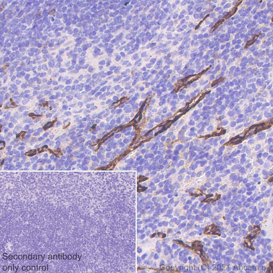 Immunohistochemistry (Formalin/PFA-fixed paraffin-embedded sections) - Anti-LYVE1 antibody [RM1008] - BSA and Azide free (AB282748), expandable thumbnail
