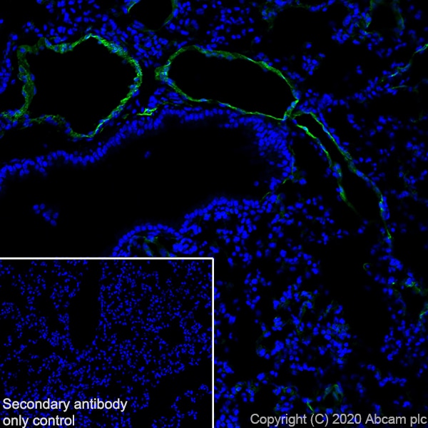 Immunohistochemistry (Frozen sections) - Anti-LYVE1 antibody [RM1008] - BSA and Azide free (ab282748), expandable thumbnail