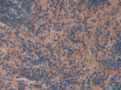 Immunohistochemistry (Formalin/PFA-fixed paraffin-embedded sections) - Anti-LZP antibody (AB232686)