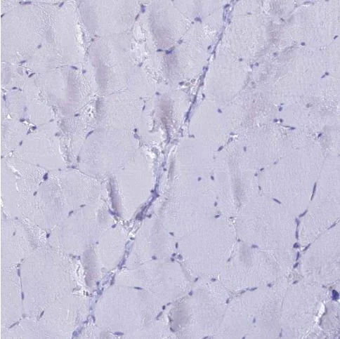 Immunohistochemistry (Formalin/PFA-fixed paraffin-embedded sections) - Anti-LZTFL1 antibody (AB187918)
