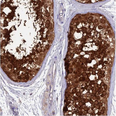 Immunohistochemistry (Formalin/PFA-fixed paraffin-embedded sections) - Anti-LZTFL1 antibody (AB187918)