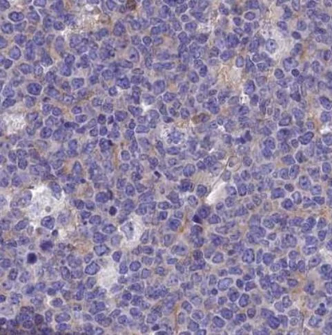 Immunohistochemistry (Formalin/PFA-fixed paraffin-embedded sections) - Anti-LZTFL1 antibody (AB187918)