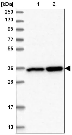 Western blot - Anti-LZTFL1 antibody (AB187918)