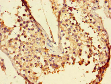 Immunohistochemistry (Formalin/PFA-fixed paraffin-embedded sections) - Anti-LZTFL1 antibody (AB236795)