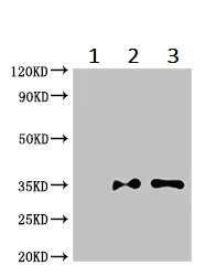 Immunoprecipitation - Anti-LZTFL1 antibody (AB236795)