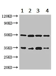 Western blot - Anti-LZTFL1 antibody (AB236795)