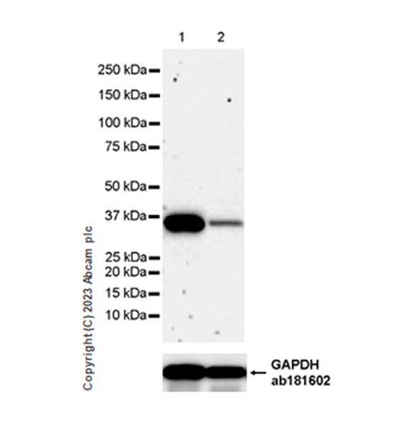 Western blot - Anti-LZTFL1 antibody [EPR27975-54] (AB313634), expandable thumbnail