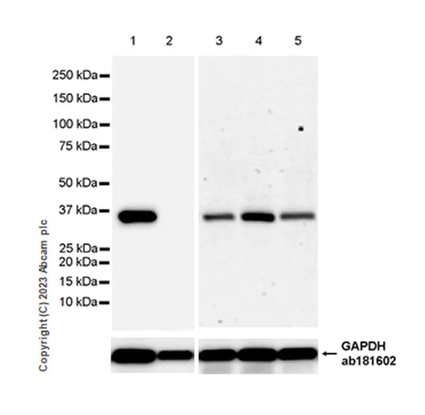 Western blot - Anti-LZTFL1 antibody [EPR27975-54] - BSA and Azide free (AB313635)