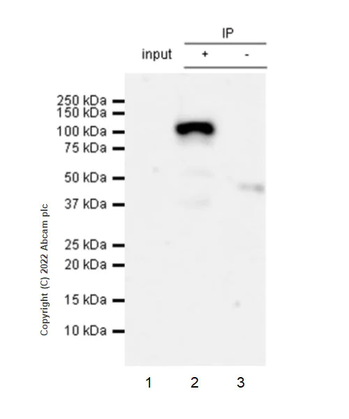 Immunoprecipitation - Anti-LZTR1 antibody [EPR25253-51] - BSA and Azide free (AB289988)