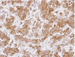 Immunohistochemistry (Formalin/PFA-fixed paraffin-embedded sections) - Anti-LZTS1/FEZ1 antibody (AB127035)