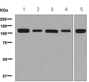 Western blot - Anti-M Cadherin antibody [EP5756] - BSA and Azide free (AB284800)