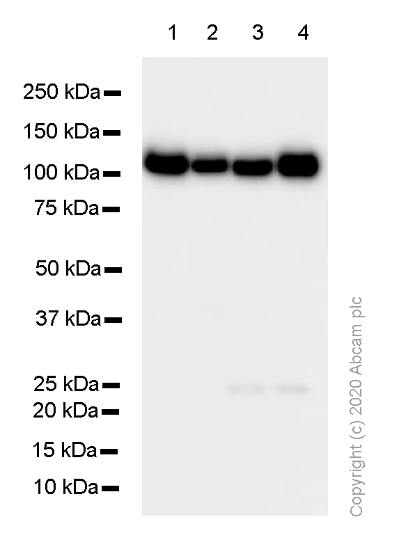 Western blot - Anti-M Cadherin antibody [EP5756] - BSA and Azide free (AB284800)