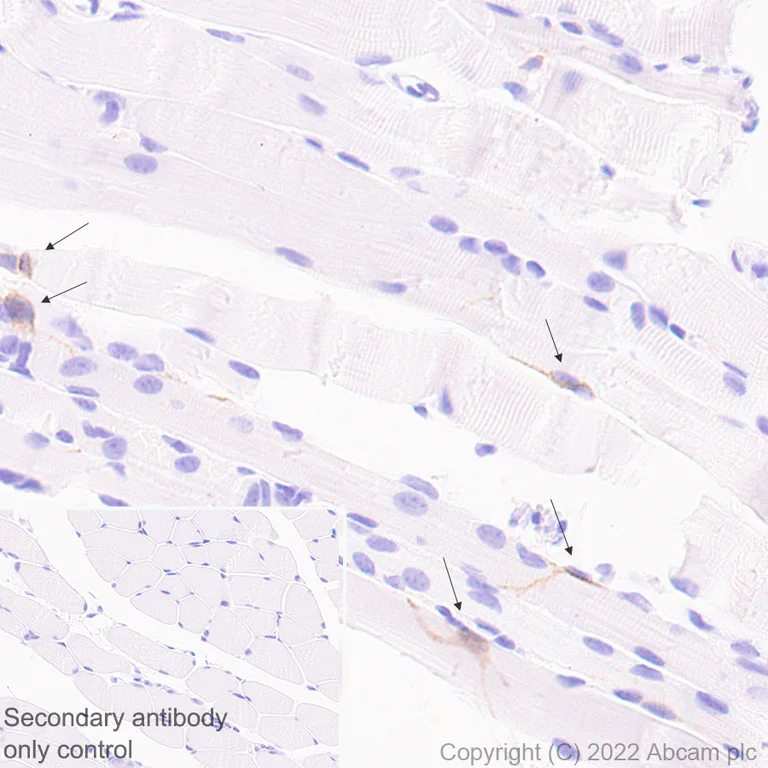Immunohistochemistry (Formalin/PFA-fixed paraffin-embedded sections) - Anti-M Cadherin antibody [EPR25401-63] (AB290732)