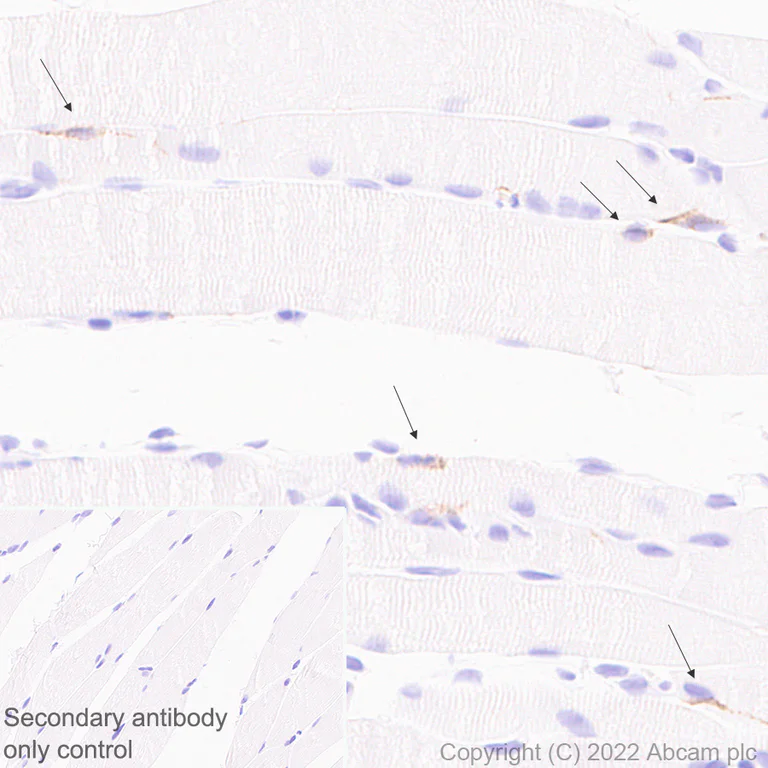 Immunohistochemistry (Formalin/PFA-fixed paraffin-embedded sections) - Anti-M Cadherin antibody [EPR25401-63] (AB290732)