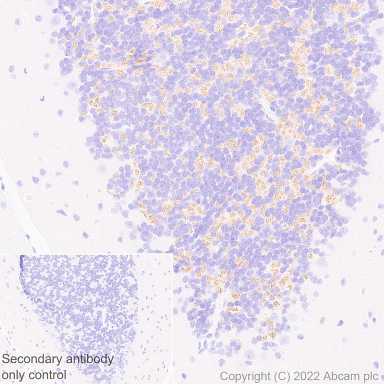 Immunohistochemistry (Formalin/PFA-fixed paraffin-embedded sections) - Anti-M Cadherin antibody [EPR25401-63] (AB290732)
