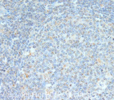Immunohistochemistry (Formalin/PFA-fixed paraffin-embedded sections) - Anti-M-CSF antibody (AB99178)