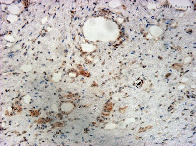 Immunohistochemistry (Formalin/PFA-fixed paraffin-embedded sections) - Anti-M-CSF antibody (AB99178), expandable thumbnail