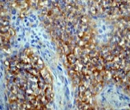 Immunohistochemistry (Formalin/PFA-fixed paraffin-embedded sections) - Anti-M-CSF antibody [EP1179Y] (AB52864)