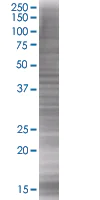SDS-PAGE - M-CSF overexpression 293T lysate (whole cell) (AB94076)