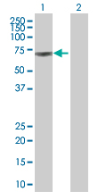 Western blot - M-CSF overexpression 293T lysate (whole cell) (AB94076)