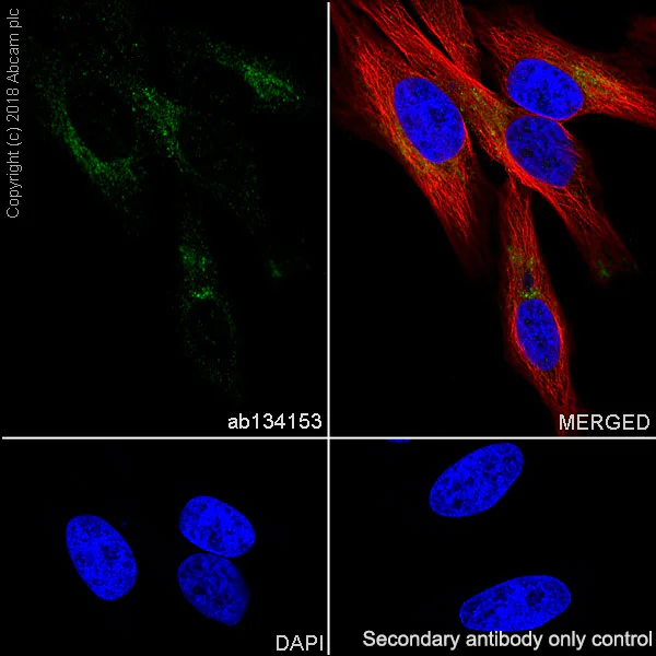 Immunocytochemistry/ Immunofluorescence - Anti-M6PR (cation dependent) antibody [EPR7691] (AB134153)