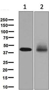 Western blot - Anti-M6PR (cation dependent) antibody [EPR7691] (AB134153)