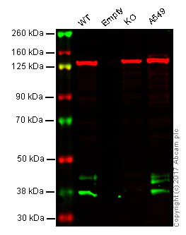 Western blot - Anti-M6PR (cation dependent) antibody [EPR7691] (AB134153)