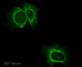 M6PR (cation independent)抗体[EPR6599] - Lysosome Membrane Marker ...
