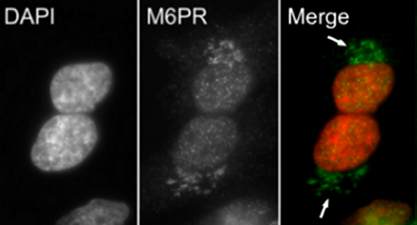Immunocytochemistry/ Immunofluorescence - Anti-M6PR (cation independent) antibody (AB12894)