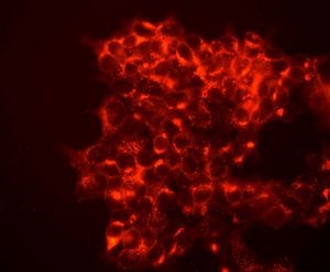 Immunocytochemistry/ Immunofluorescence - Anti-M6PR (cation independent) antibody [EPR6599] (ab124767), expandable thumbnail