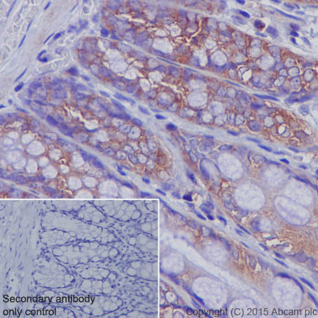 Immunohistochemistry (Formalin/PFA-fixed paraffin-embedded sections) - Anti-M6PR (cation independent) antibody [EPR6599] (ab124767), expandable thumbnail