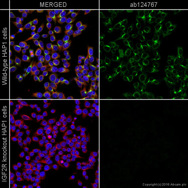 Immunocytochemistry/ Immunofluorescence - Anti-M6PR (cation independent) antibody [EPR6599] - Lysosome Membrane Marker (AB124767)