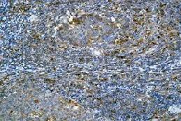 Immunohistochemistry (Formalin/PFA-fixed paraffin-embedded sections) - Anti-M6PR (cation independent) antibody [EPR6599] - Lysosome Membrane Marker (AB124767)