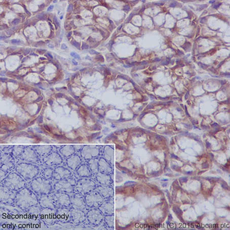 Immunohistochemistry (Formalin/PFA-fixed paraffin-embedded sections) - Anti-M6PR (cation independent) antibody [EPR6599] - Lysosome Membrane Marker (AB124767)