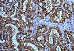 Immunohistochemistry (Formalin/PFA-fixed paraffin-embedded sections) - Anti-M6PR (cation independent) antibody [EPR6599] - Lysosome Membrane Marker (AB124767)