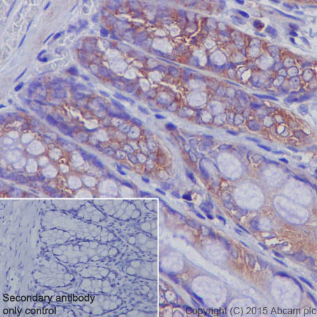 Immunohistochemistry (Formalin/PFA-fixed paraffin-embedded sections) - Anti-M6PR (cation independent) antibody [EPR6599] - Lysosome Membrane Marker (AB124767)