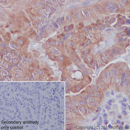 Immunohistochemistry (Formalin/PFA-fixed paraffin-embedded sections) - Anti-M6PR (cation independent) antibody [EPR6599] - Lysosome Membrane Marker (AB124767)