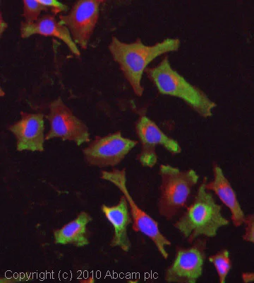 Immunocytochemistry/ Immunofluorescence - Anti-M6PR (cation independent) antibody - Lysosome Membrane Marker (AB32815)