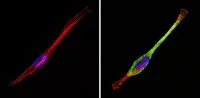 Immunocytochemistry/ Immunofluorescence - Anti-M6PR (cation independent) antibody - Lysosome Membrane Marker (AB32815)