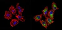 Immunocytochemistry/ Immunofluorescence - Anti-M6PR (cation independent) antibody - Lysosome Membrane Marker (AB32815)