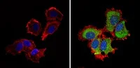 Immunocytochemistry/ Immunofluorescence - Anti-M6PR (cation independent) antibody - Lysosome Membrane Marker (AB32815)