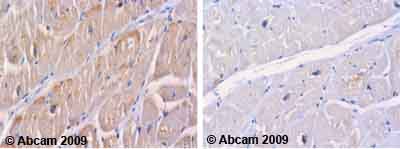 Immunohistochemistry (Formalin/PFA-fixed paraffin-embedded sections) - Anti-M6PR (cation independent) antibody - Lysosome Membrane Marker (AB32815)