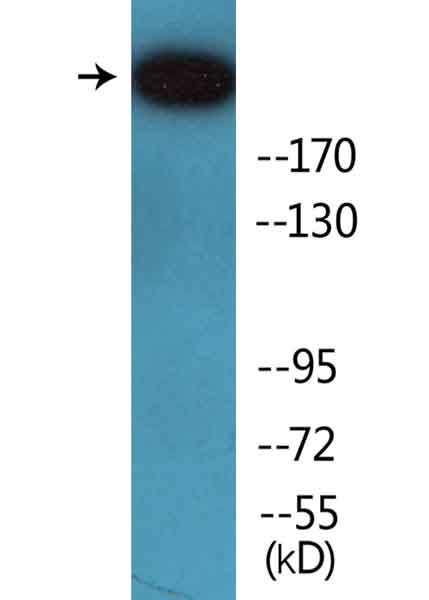 Western blot - Anti-M6PR (cation independent) (phospho S2409) antibody (AB138453)