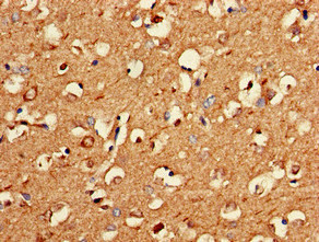 Immunohistochemistry (Formalin/PFA-fixed paraffin-embedded sections) - Anti-MA2 antibody (AB234740)