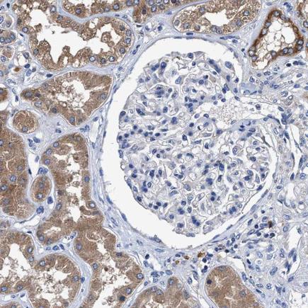 Immunohistochemistry (Formalin/PFA-fixed paraffin-embedded sections) - Anti-MACC1 antibody (AB223710)
