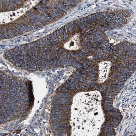 Immunohistochemistry (Formalin/PFA-fixed paraffin-embedded sections) - Anti-MACC1 antibody (AB223710)