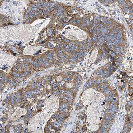 Immunohistochemistry (Formalin/PFA-fixed paraffin-embedded sections) - Anti-MACC1 antibody (AB223710)