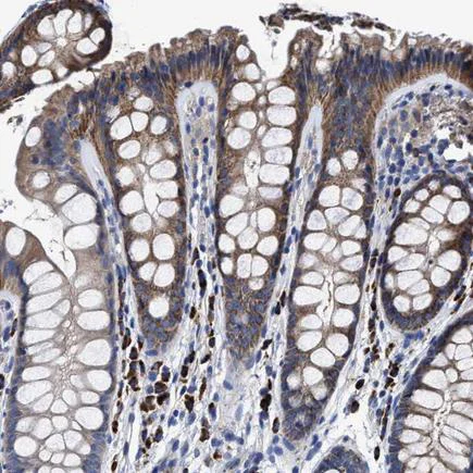 Immunohistochemistry (Formalin/PFA-fixed paraffin-embedded sections) - Anti-MACC1 antibody (AB223710)